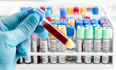 blood test