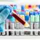 blood test