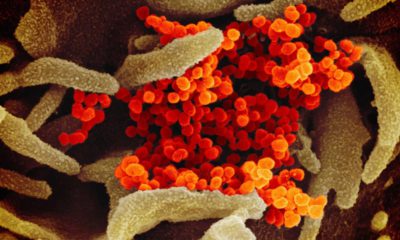 Photo of the coronavirus under a microscope