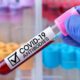 Photo of a blood vial labeled "COVID-19 antibodies"